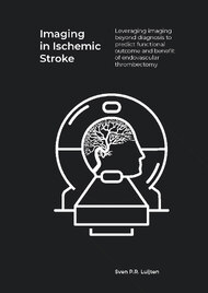 Imaging in Ischemic Stroke
