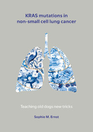 KRAS mutations in non-small cell lung cancer