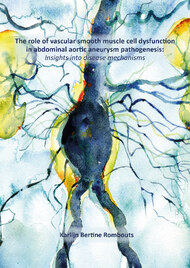 The role of vascular smooth muscle cell dysfunction in abdominal aortic aneurysm pathogenesis: