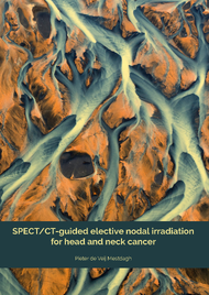 SPECT/CT-guided elective nodal irradiation for head and neck cancer