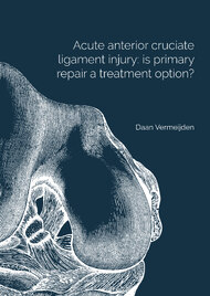 Acute anterior cruciate ligament injury: