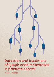 Detection and treatment of lymph node metastases in prostate cancer