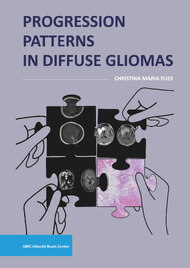 Progression Patterns In Diffuse Gliomas