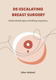 De-escalating breast surgery