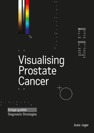 Visualizing Prostate Cancer Image-Guided Diagnostic Strategies