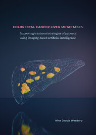 Colorectal Cancer Liver Metastases