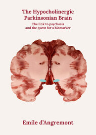 The Hypocholinergic Parkinsonian Brain