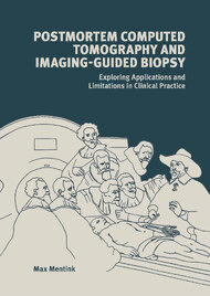 Postmortem Computed Tomography and Imaging-Guided Biopsy