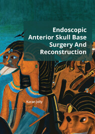 Endoscopic Anterior Skull Base Surgery And Reconstruction